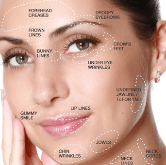 botox edinburgh facial treatment areas