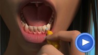 Teeth Cleaning in Edinburgh Video
